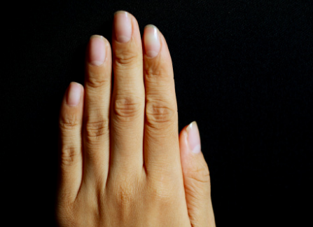 爪水虫・爪白癬の手の初期症状の写真画像。足の爪でうつる？効く薬紹介